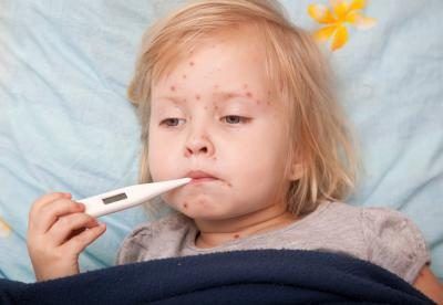 Jeune fille avec la varicelle.