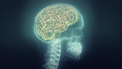 Radiographie du cerveau