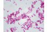 Yersinia pestis, la bactérie responsable de la peste bubonique